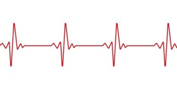 EKG vs. ECG: What’s the difference?